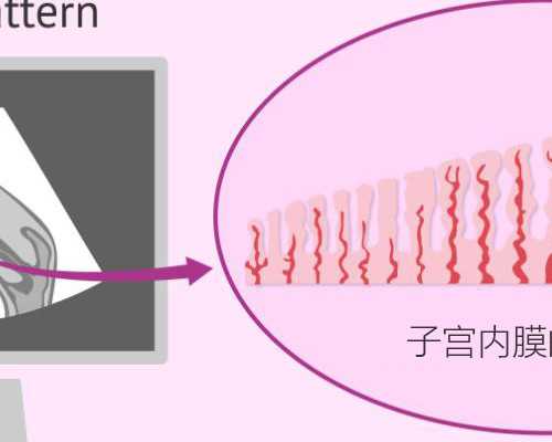 告诉宝子们一个1000%催姨妈的法子 专业供卵代孕医院